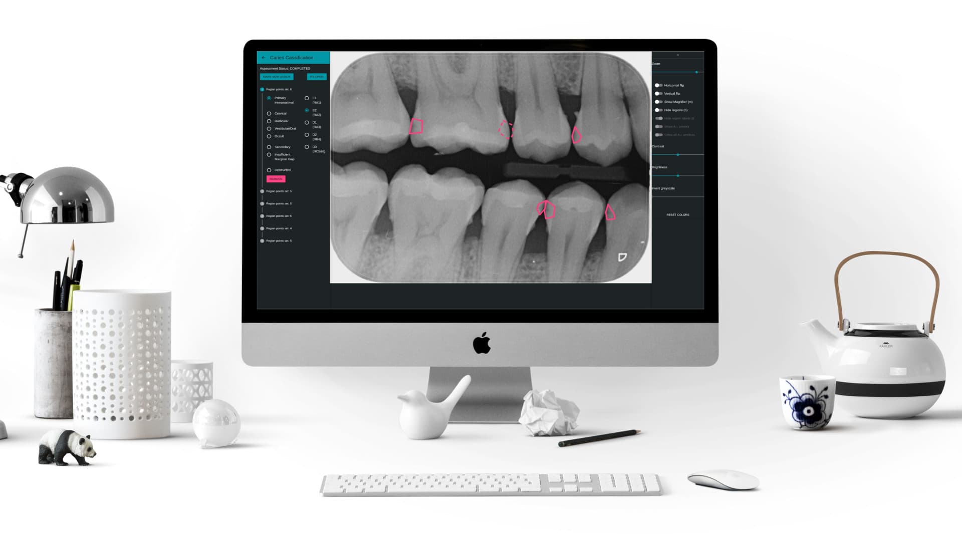DentaliQ caries
