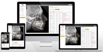 DentaliQ ortho : New Major Release