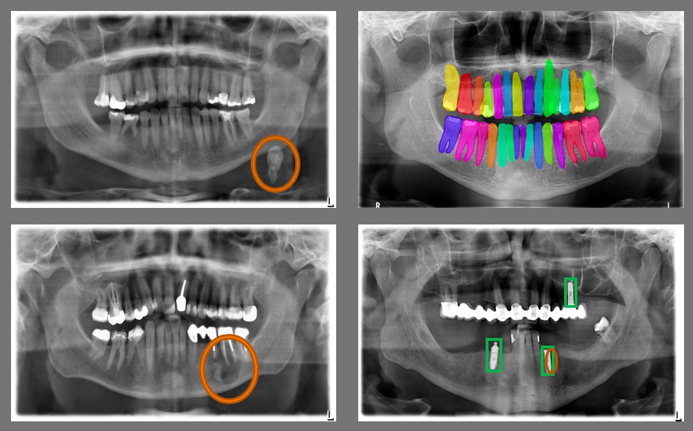 DentaliQ opg